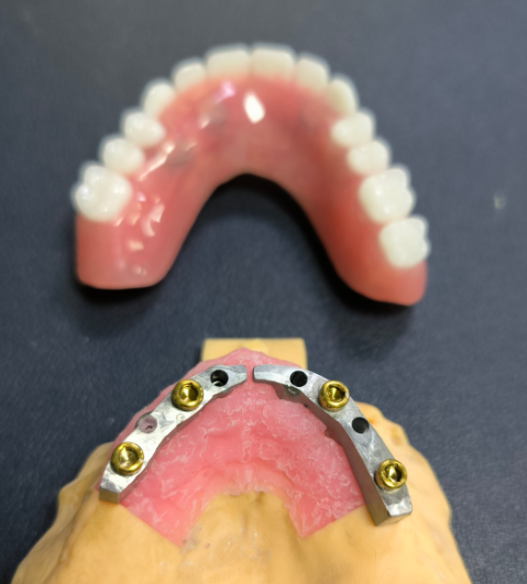 Lokátor a titánová zubná lišta