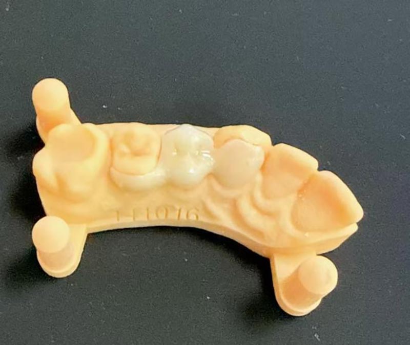 Čo potrebujete vedieť o Maryland Bridges?