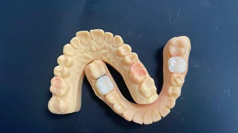 Aký je okraj ramena?