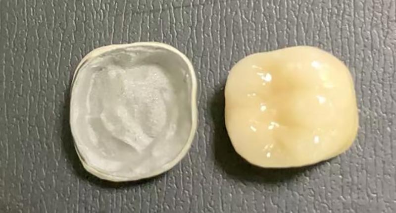 WM DENTAL LAB – popredné čínske zubné laboratórium