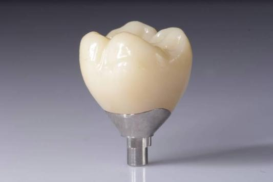 Optimalizujte svoje výsledky pomocou zirkónových výplní (korunky, mostíky, implantáty)