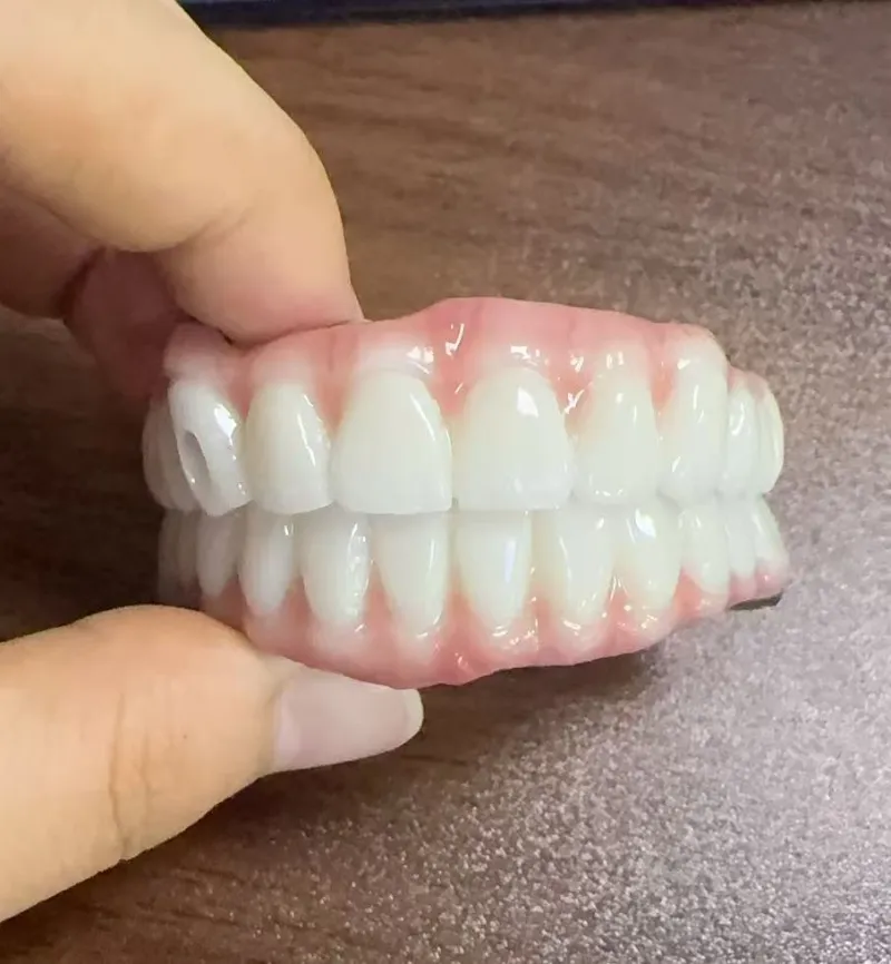 Nebezpečenstvo malocclusion