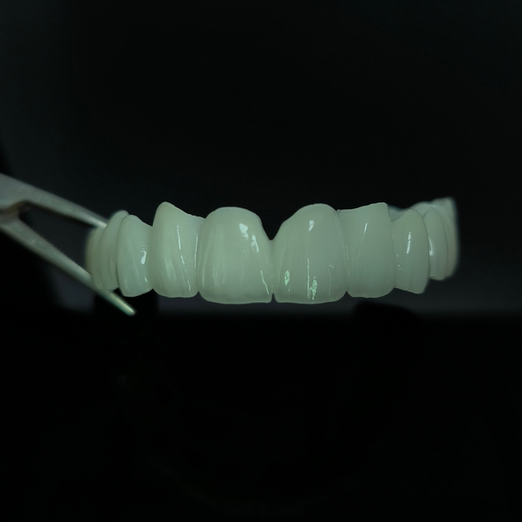 High Translucent Zirconia Bridge Layered Zirconia China Zubná práca v laboratóriu